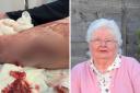 Doreen Chadwick, 86, was on Arthur Street, in Great Harwood, when she cut her leg open on her car door