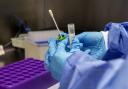 Rachel Miranda, a medical laboratory assistant (MLA), prepares Covid-19 tests for analysis in the laboratory at Whiston Hospital in Merseyside. PA Photo. Picture date: Tuesday October 20, 2020. The team of scientists are working round the clock at the