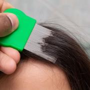 Did you know you can't prevent head lice?